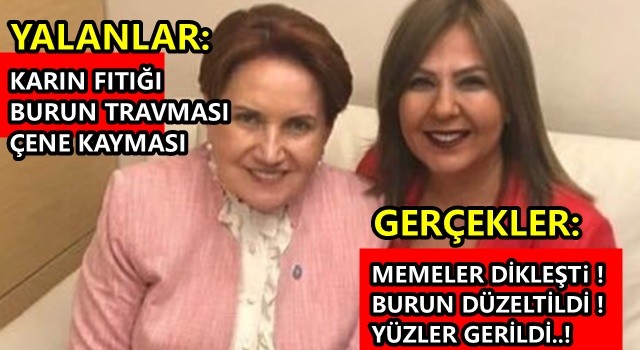 Akşener'in sağ koluna 'estetik vurgunu' iddiası 