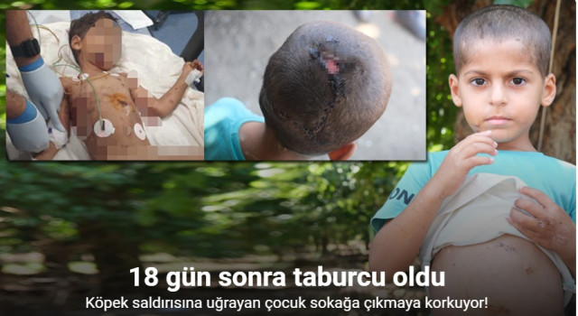 Köpeklerin saldırdığı çocuk 18 gün sonra taburcu oldu