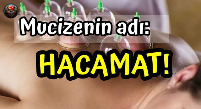 Bel ve Boyun Fıtığı tedavisinde 'Hacamat' Mucizesi