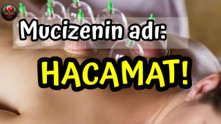 Bel ve Boyun Fıtığı tedavisinde 'Hacamat' Mucizesi