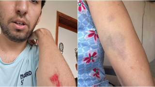 Akçatekir'de 'Köpek Besledin' dayağı iddiası