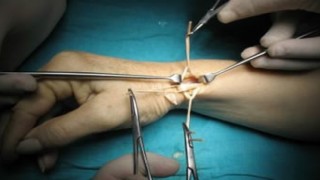 El Cerrahisi & Mikro Cerrahi: Uzman Ellerle Hayata Dokunan Cerrahi Sanatı